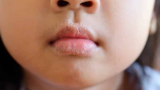 Trockene Lippen Bei Babys Haushalt Und Wohnen